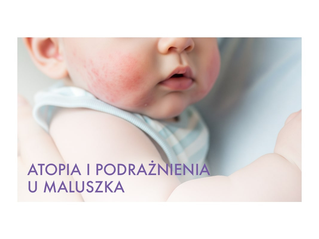Atopia i podrażnienia u maluszka: jak zadbać o wrażliwą skórę?